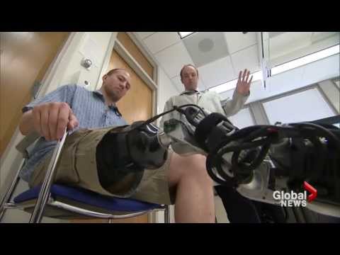 Mind-controlled prosthetic leg