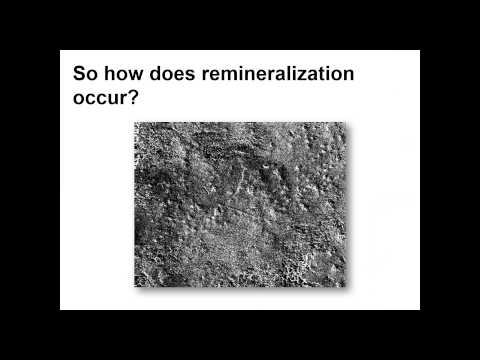 Remineralization- Why Fluoride Isn't Enough