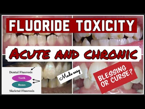 FLUORIDE TOXICITY II ACUTE AND CHRONIC II DENTAL FLUOROSIS II PUBLIC HEALTH DENTISTRY